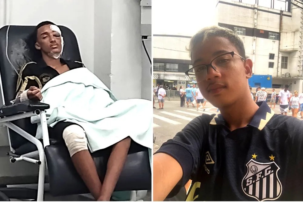 Motorista bêbado atropela e mata adolescente na Imigrantes; outro jovem sofreu fratura no crânio
