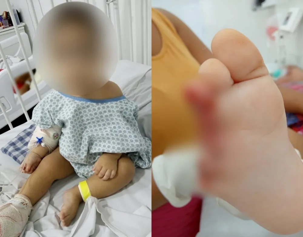 Bebê tem dois dedos decepados por extintor de incêndio em creche;pais cobram responsabilidade