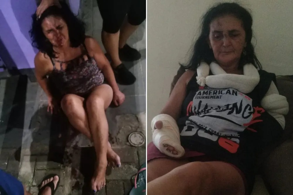 Mulher joga vendedora de dentro do ônibus, agride, xinga e deixa vítima com várias fraturas e desmaiada