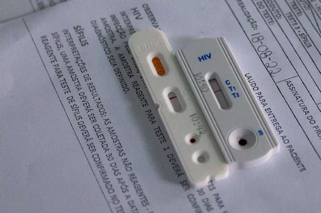 Julho Amarelo: São Sebastião realiza testes rápidos para detecção de Hepatites B e C e Sífilis