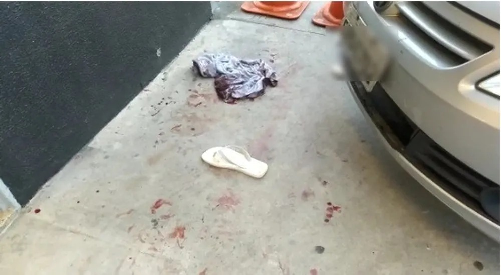 Baleado, homem dirige até Batalhão para pedir socorro; pode ser vingaça